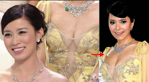 女星装嫩被高颧骨泄底