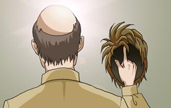 头顶脱发严重怎么办 头顶没有头发好尴尬