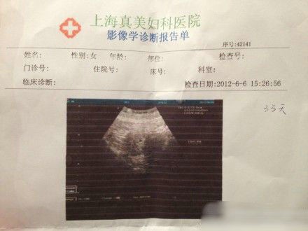袁莉老公曝妻怀孕一月,晒其B超照。