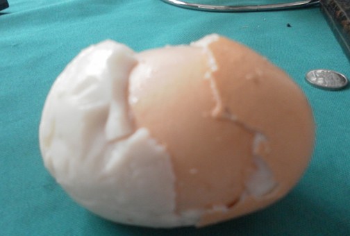 母鸡下出罕见蛋中蛋后死亡 专家称变异