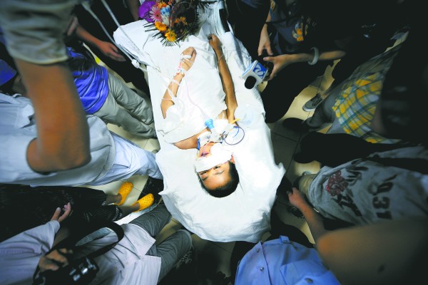 山东13岁男孩肛门被气泵击穿 受害细节被公布