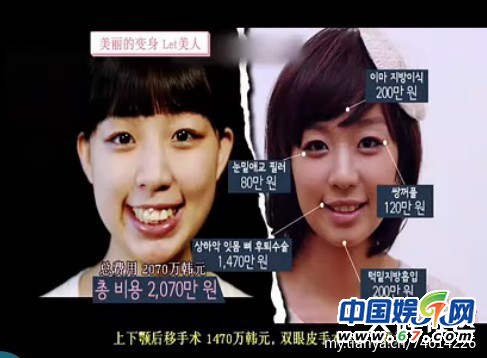 多图剧透韩国整容节目《LET 美人》近几期，最爱小V脸，人瘦就能美