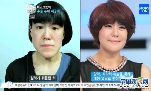 多图剧透韩国整容节目《LET 美人》近几期，最爱小V脸，人瘦就能美