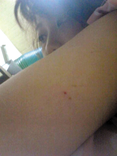 11月25日,窦某在发布的网帖中公布了刺中自己的针头和胳臂上的红点。