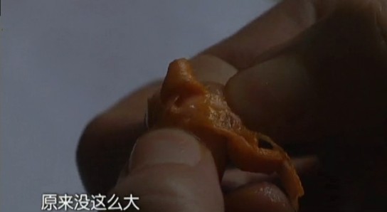 亨氏蔬菜泥吃出塑料绳 7月大宝宝卡住喉咙 亨氏蔬菜泥吃出塑料绳 7月大宝宝卡住喉咙