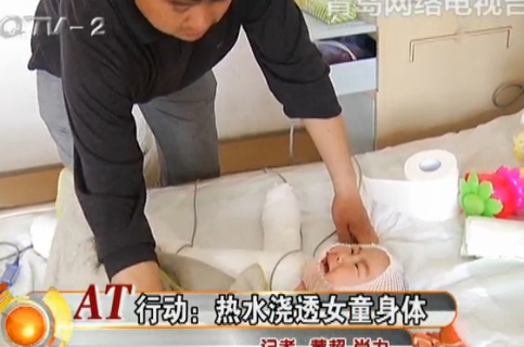 热水浇透女婴身体 父母情急下涂酱油适得其反 热水浇透女婴身体 父母情急下涂酱油适得其反