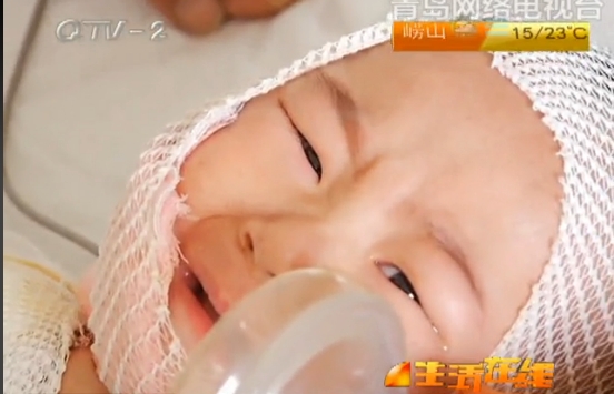 热水浇透女婴身体 父母情急下涂酱油适得其反 热水浇透女婴身体 父母情急下涂酱油适得其反