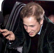 植发效果怎么样,植发后是怎么样的呢