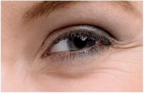 还在为去鱼尾纹发愁?分享去鱼尾纹最有效的眼霜