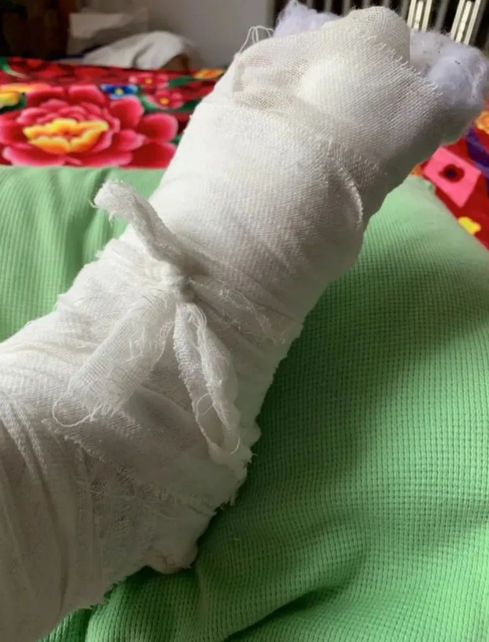 黄岛一市民去这家4s店修车被压断脚趾, 索赔难!