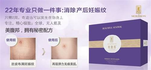 产后妊娠纹能消除吗?它能轻松赶走妊娠纹