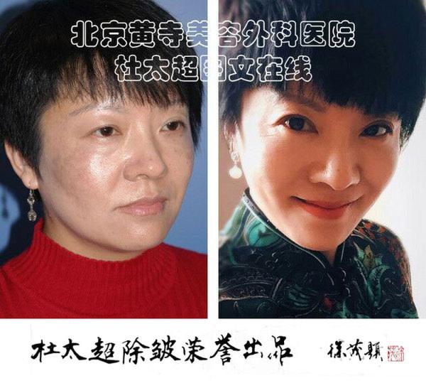 1489712644715564.jpg 1489712644715564.jpg