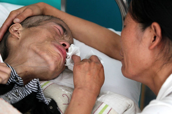 17岁癌症少年无钱治疗含泪捐全身器官组图