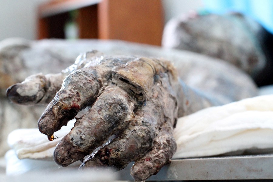 河南农民18.55万元被烧成灰 家人重伤(组图) - 青岛新闻网