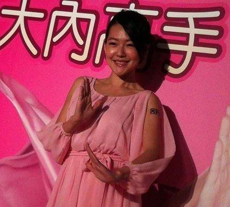 小S胸部变形下垂