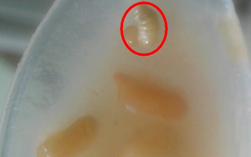 青岛娃哈哈八宝粥喝出肉虫 青岛娃哈哈八宝粥喝出肉虫