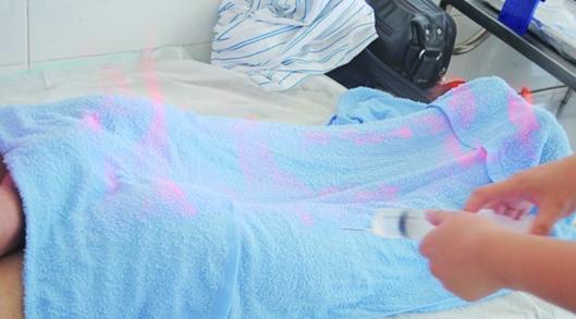 揭秘青岛火疗拔罐:盖酒精毛巾引火上身 蓝色火焰腿上跳