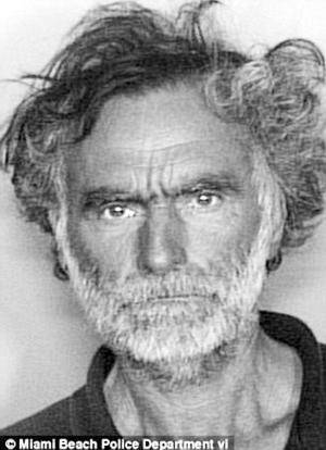 美国被啃脸男已失明 首次公开谈袭击细节