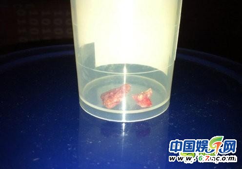 刘翔伤口拆线惨不忍睹 忍剧痛表情沮丧