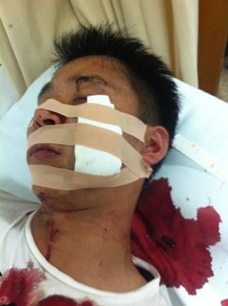 加多宝与广药再爆流血冲突 广药一员工惨遭毁容