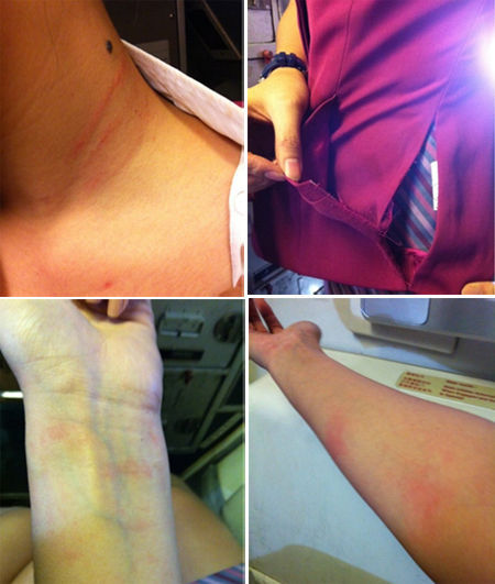 花Money买毛豆受伤图片