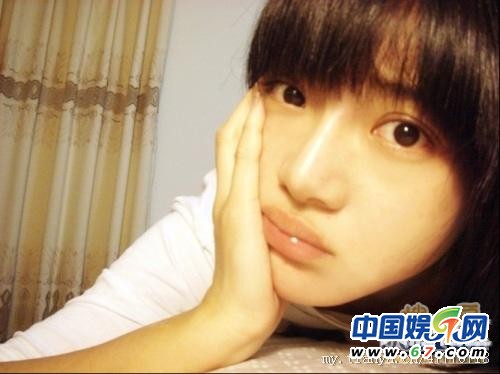 邓家佳被疑整容