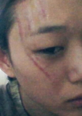 崔素拉毁容 崔素拉毁容