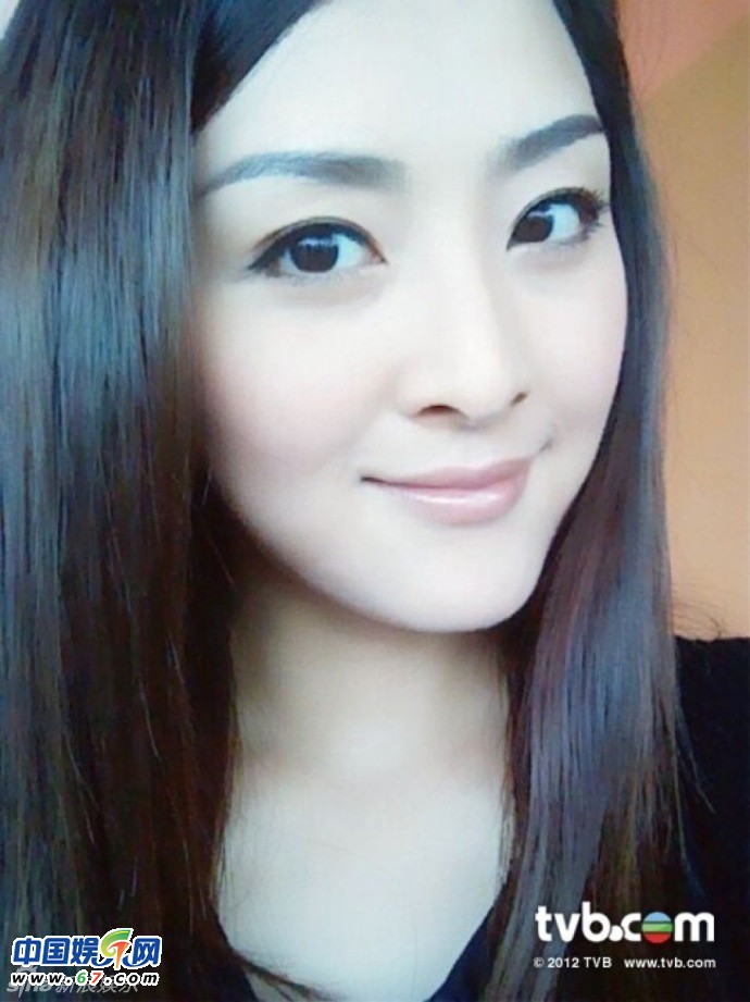 有人爆料指张名雅做过四次整形手术，还提供了一张疑似张名雅的旧照(左图)