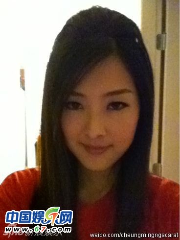 有人爆料指张名雅做过四次整形手术，还提供了一张疑似张名雅的旧照(左图)