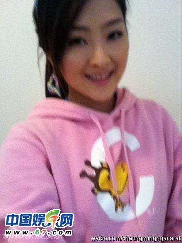 有人爆料指张名雅做过四次整形手术，还提供了一张疑似张名雅的旧照(左图)