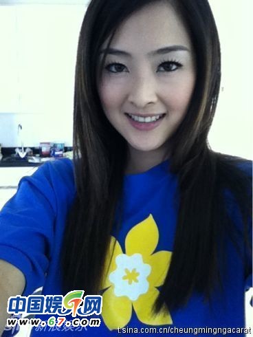 有人爆料指张名雅做过四次整形手术，还提供了一张疑似张名雅的旧照(左图)