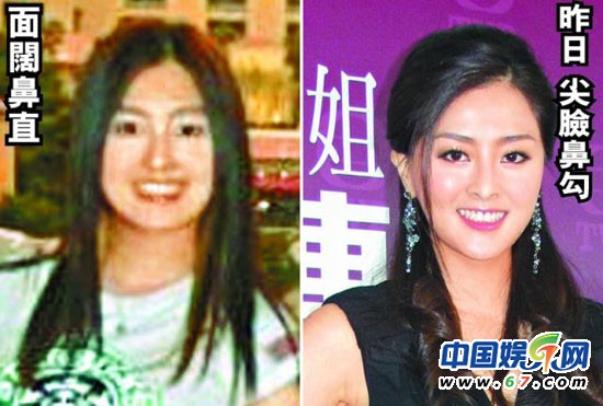 港姐张名雅被指整容四次 私生活混乱集邮男星