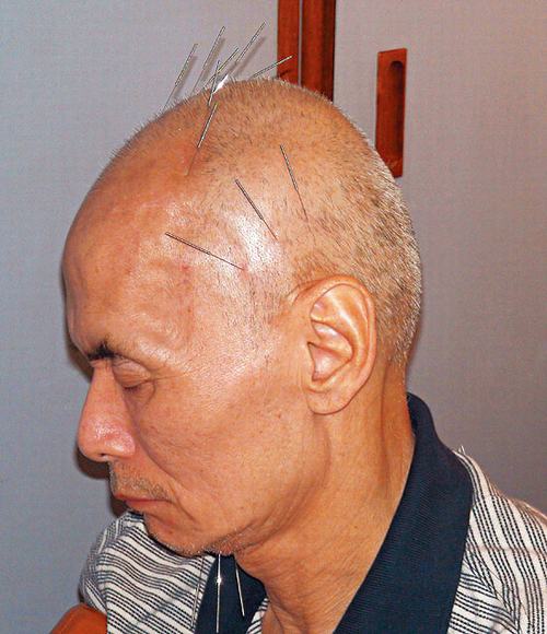 探秘刘家辉老人院生活：亲证子女谋产 治疗吃尽苦头