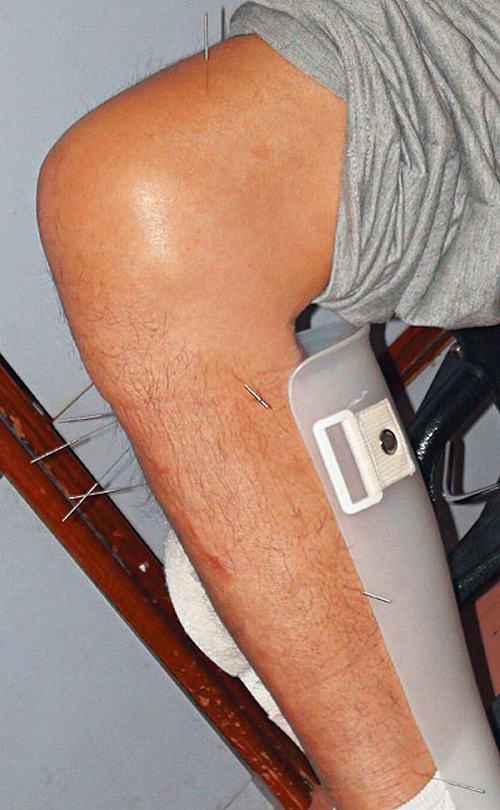 探秘刘家辉老人院生活：亲证子女谋产 治疗吃尽苦头