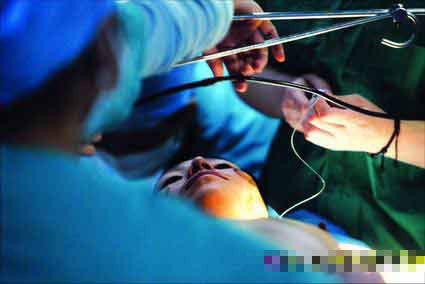 变性手术全程首度公开