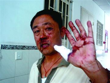 男子街头捅伤小贩威胁群众 邻居空手夺刀将其制服