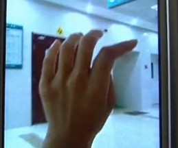 女子晒袜子滴水被亲戚掰断手指 造型诡异难复位