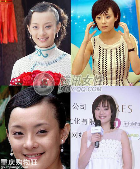 整容不是万能的 盘点明星整容也去不掉的小缺陷