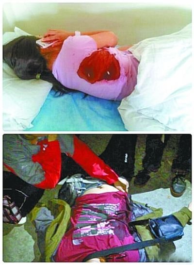 华山捅游客嫌犯未经伤者辨认 警方称没来得及