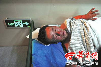 在周至县人民医院，一名伤者在讲述火灾中让他惊恐的一幕 本报记者李晖 摄
