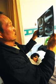 15岁少女缝衣针蹊跷扎进心脏 连续一年肚子疼 15岁少女缝衣针蹊跷扎进心脏 连续一年肚子疼