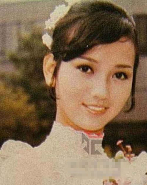 58岁赵雅芝长腿惊现长疤痕 偷情被暴打内幕遭曝光