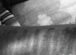 美容院脱毛反被烫伤 退款竟需签免责协议