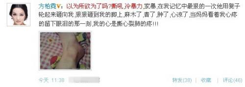 残忍的明星家暴 太惨了！