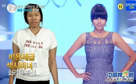 多图剧透韩国整容节目《LET 美人》近几期，最爱小V脸，人瘦就能美