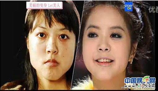 多图剧透韩国整容节目《LET 美人》近几期，最爱小V脸，人瘦就能美