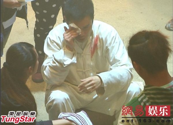 陈奕迅失足摔破睾丸成龙险丧命 盘点明星“悲催”受伤史