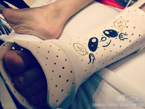 黄晓明自曝受伤照片