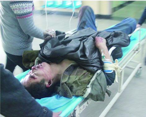 工人摔下脚手架颅骨塌陷 负责人竟笑称小事