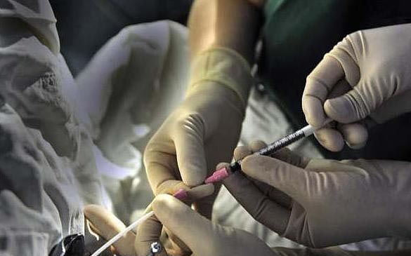 试管婴儿取卵抽精全程